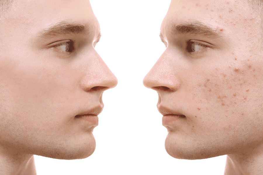 Body Rejuvenation - SKINFUDGE Aesthetics | Painless, No Side Effects, Natural Looking Results