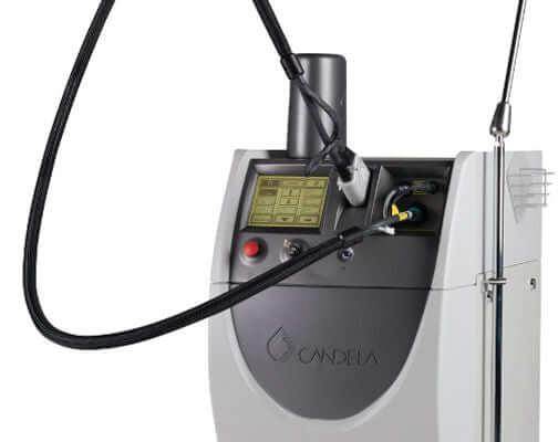 Laser Hair Removal Lahore (Body Areas) Male/Female - SKINFUDGE Aesthetics | Painless, No Side Effects, Natural Looking Results