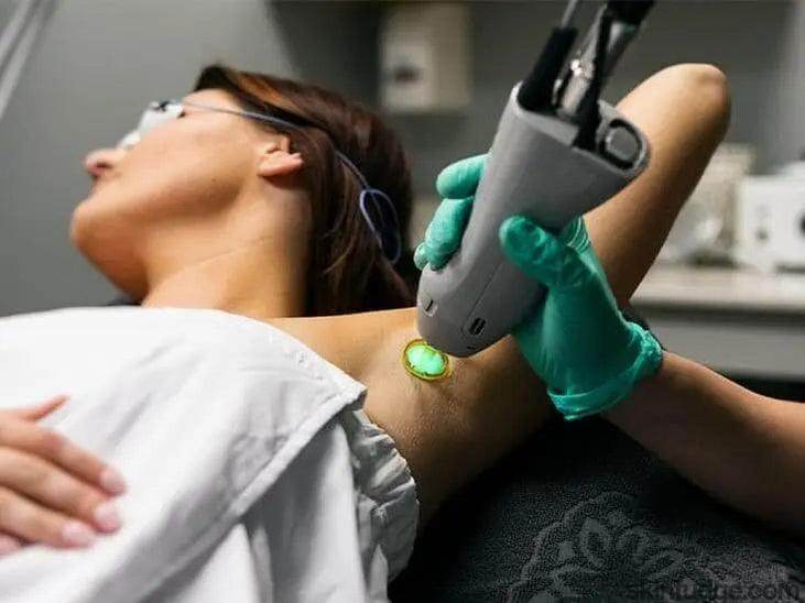 Body Laser Hair Removal - Female - SKINFUDGE Aesthetics | Painless, No Side Effects, Natural Looking Results