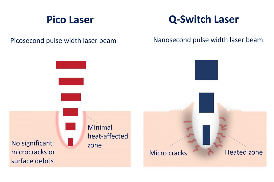 Difference Between Q-switch and Pico-Switch Lasers - SKINFUDGE Aesthetics | Painless, No Side Effects, Natural Looking Results