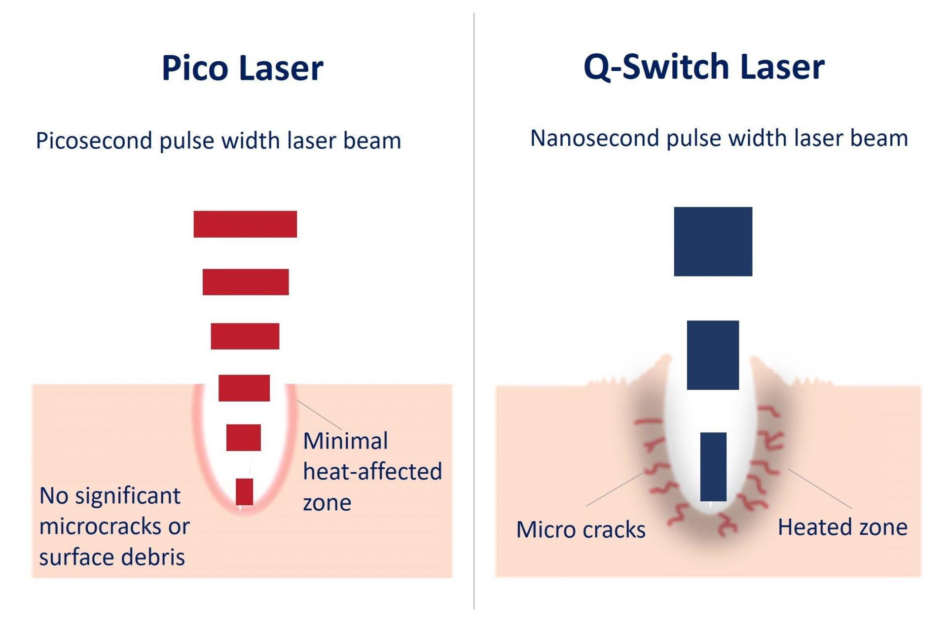 Difference Between Q-switch and Pico-Switch Lasers - SKINFUDGE Aesthetics | Painless, No Side Effects, Natural Looking Results