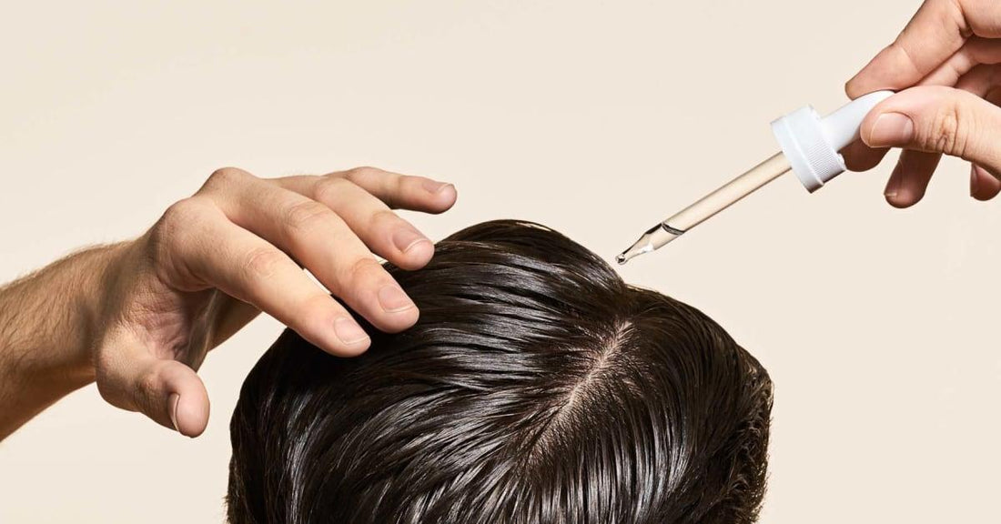 Minoxidil vs Finasteride vs Procapil For Hair Loss - SKINFUDGE Aesthetics | Painless, No Side Effects, Natural Looking Results