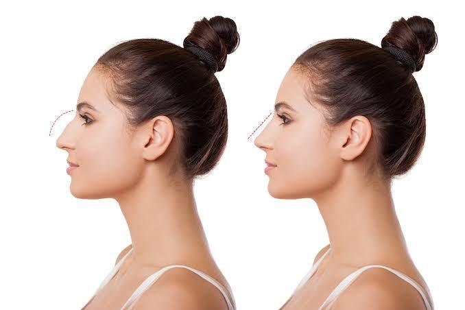 Post-Procedure Recovery: What to Expect and How to Care for Your Skin - SKINFUDGE Aesthetics | Painless, No Side Effects, Natural Looking Results