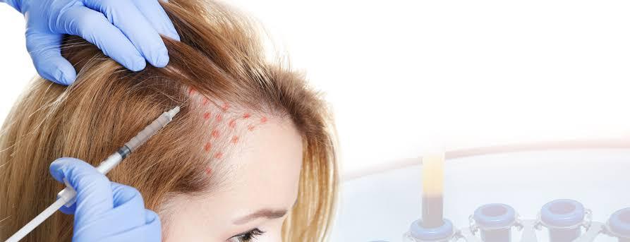 Benefits Of Injecting 2ml vs 4ml PRP / PRF in Scalp For Hair Regrowth - SKINFUDGE Aesthetics | Painless, No Side Effects, Natural Looking Results