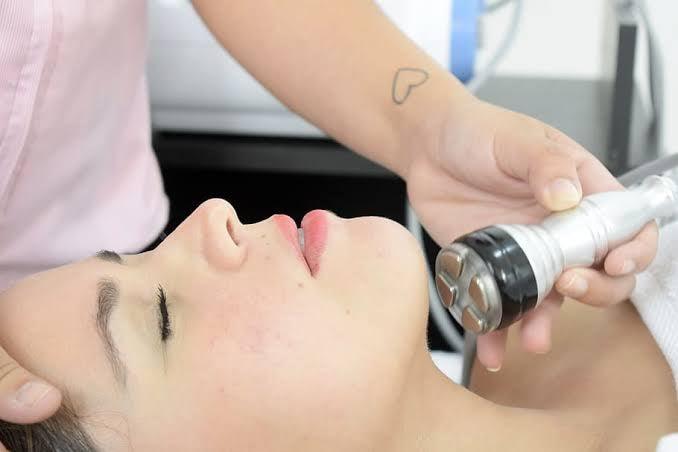 Is Laser Hair Removal Effective On Blonde And White Skin? - SKINFUDGE Aesthetics | Painless, No Side Effects, Natural Looking Results