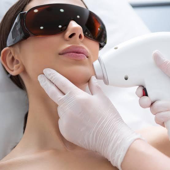 How does Laser Hair Removal Work on the Face? - SKINFUDGE Aesthetics | Painless, No Side Effects, Natural Looking Results