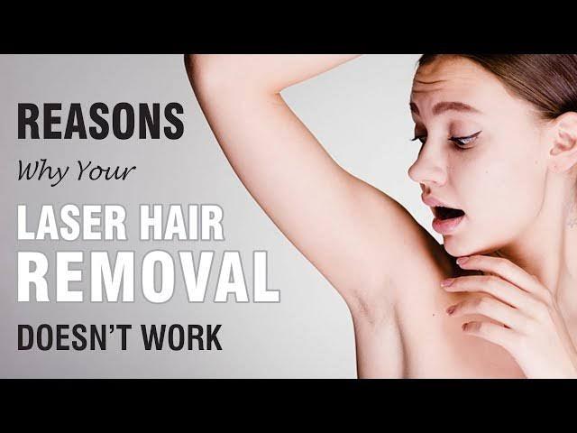 What Can You Do When Laser Hair Removal Doesn't Work? - SKINFUDGE Aesthetics | Painless, No Side Effects, Natural Looking Results