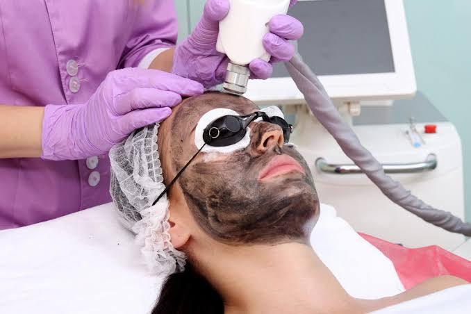 What Are Laser Hair Removal Trends? - SKINFUDGE Aesthetics | Painless, No Side Effects, Natural Looking Results