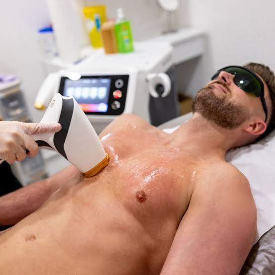 What are laser hair removal benefits, side effects, and costs? - SKINFUDGE Aesthetics | Painless, No Side Effects, Natural Looking Results