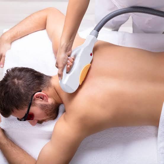 Is laser hair removal effective for heavy hairy men's back? - SKINFUDGE Aesthetics | Painless, No Side Effects, Natural Looking Results