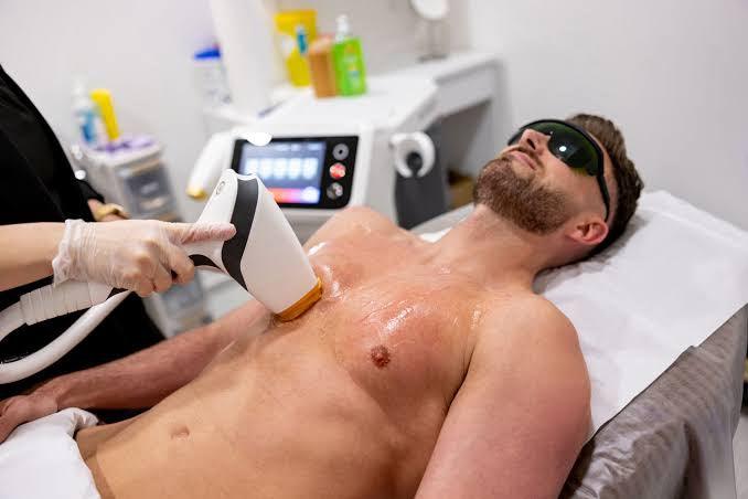 What is laser hair removal for men, and how does it work? - SKINFUDGE Aesthetics | Painless, No Side Effects, Natural Looking Results