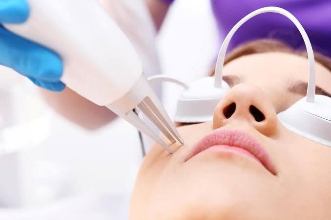 Is laser treatment to treat acne scars really harmful? - SKINFUDGE Aesthetics | Painless, No Side Effects, Natural Looking Results