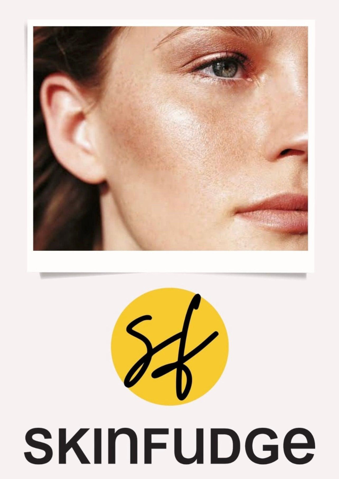 What is the Good acne scar treatment clinic in Lahore, Pakistan? - SKINFUDGE Aesthetics | Painless, No Side Effects, Natural Looking Results