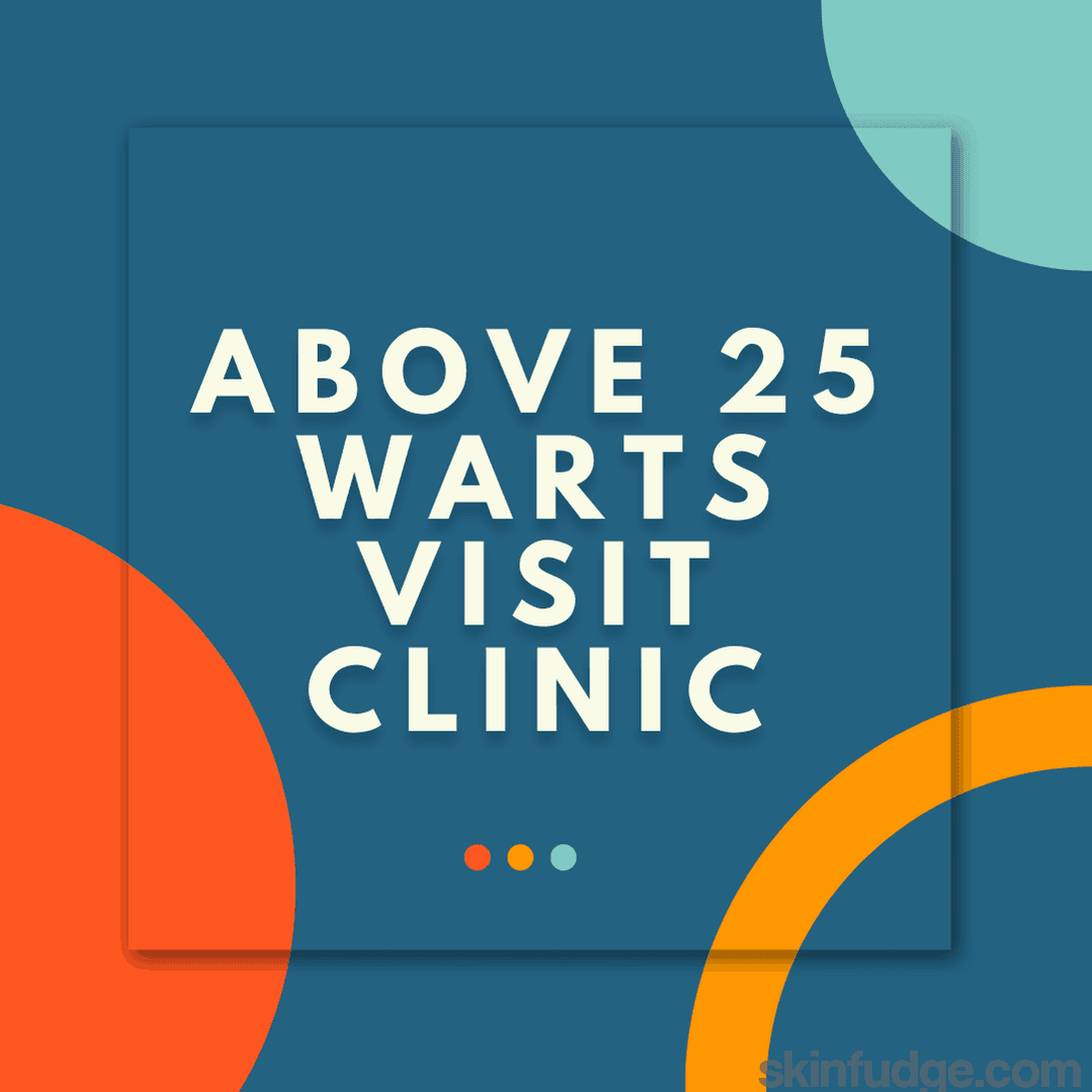 Wart Removal Treatment (Non-Genital) - SKINFUDGE Aesthetics | Painless, No Side Effects, Natural Looking Results