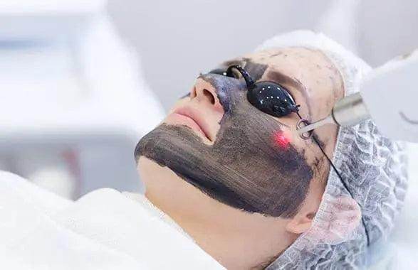 Charcoal Facial - SKINFUDGE Aesthetics | Painless, No Side Effects, Natural Looking Results