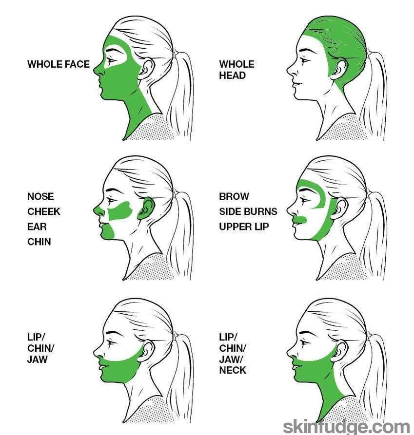 Face Laser Hair Removal - Female - SKINFUDGE Aesthetics | Painless, No Side Effects, Natural Looking Results