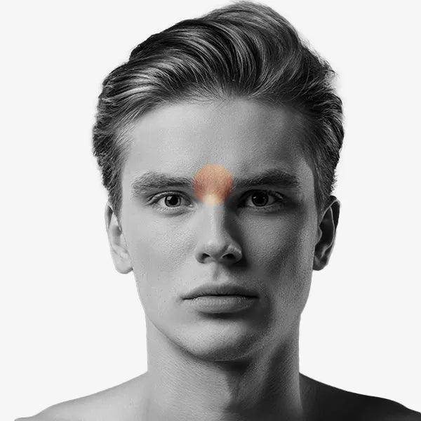 Unibrow Laser Hair Removal - SKINFUDGE Aesthetics | Painless, No Side Effects, Natural Looking Results