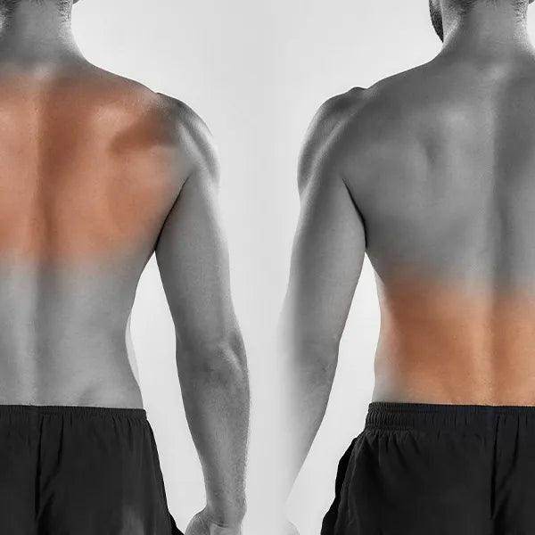 Back Laser Hair Removal - Male - SKINFUDGE Aesthetics | Painless, No Side Effects, Natural Looking Results