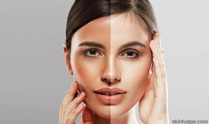 Face Whitening Treatment Consultation - SKINFUDGE Aesthetics | Painless, No Side Effects, Natural Looking Results