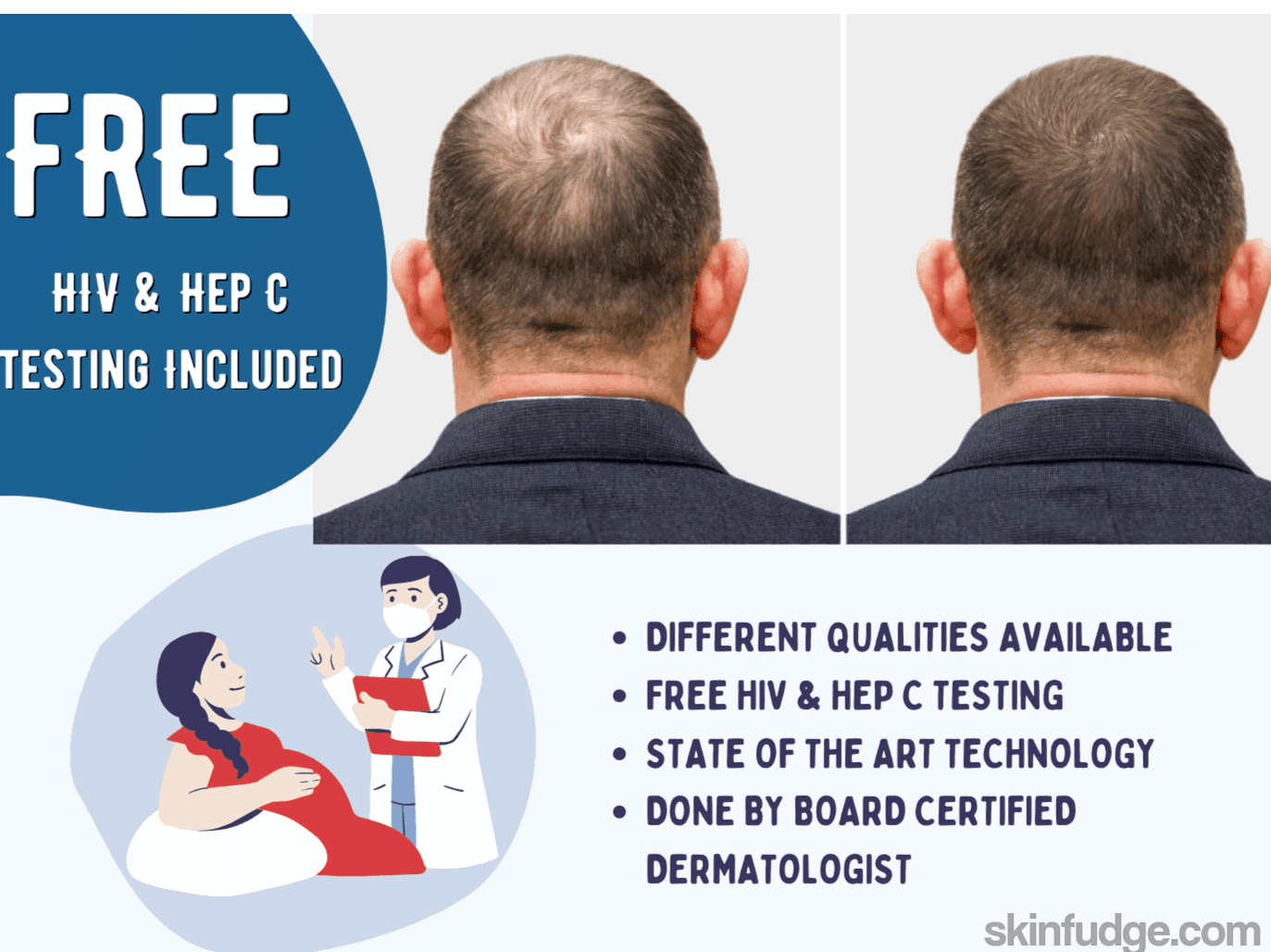 Hair Regrowth Treatment - PRP, PRF, PRGF - SKINFUDGE Aesthetics | Painless, No Side Effects, Natural Looking Results