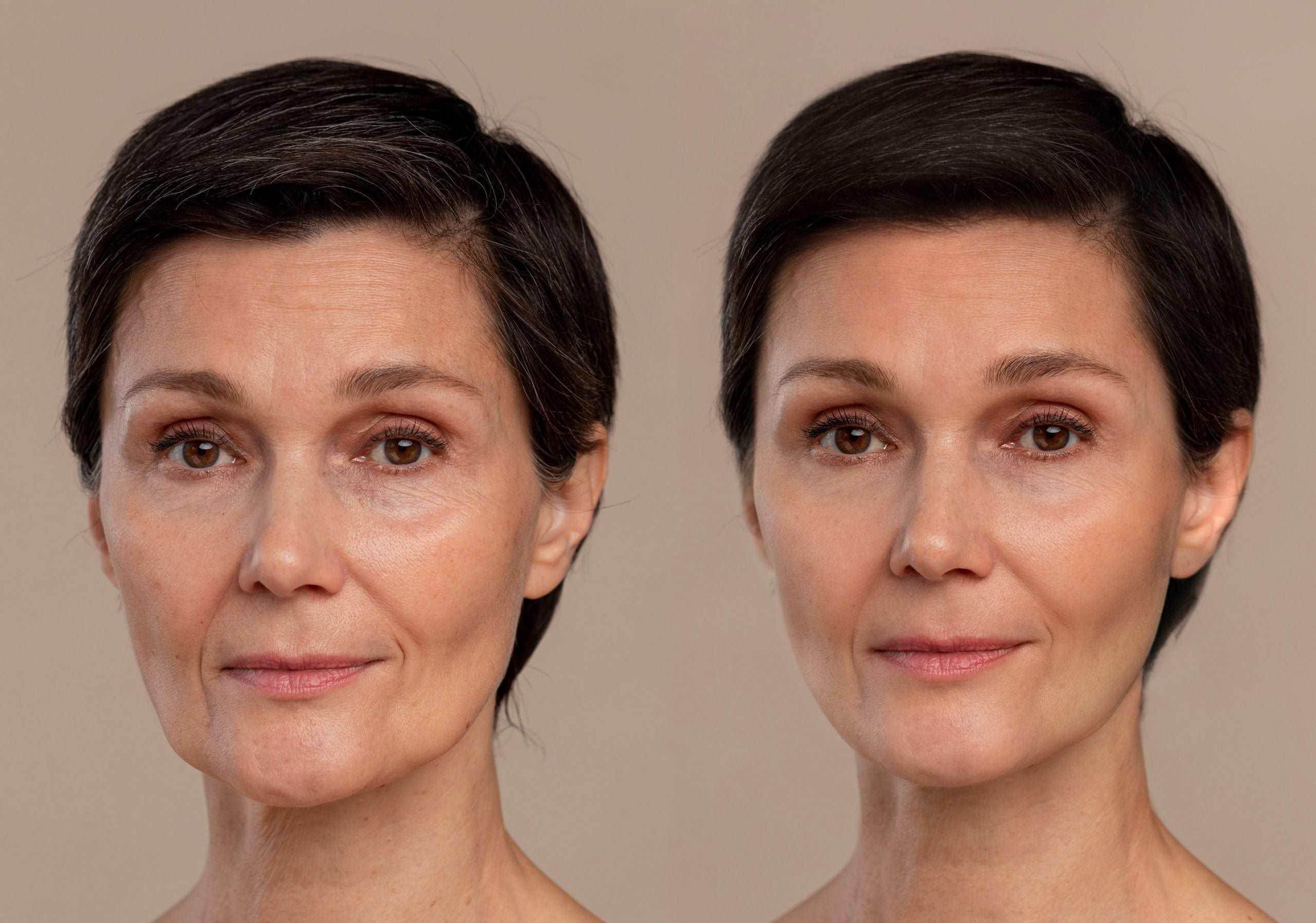 Exosome Therapy for Hair Regeneration - SKINFUDGE Aesthetics | Painless, No Side Effects, Natural Looking Results