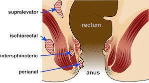 Perianal Abscess: Treatment Options-SKINFUDGE