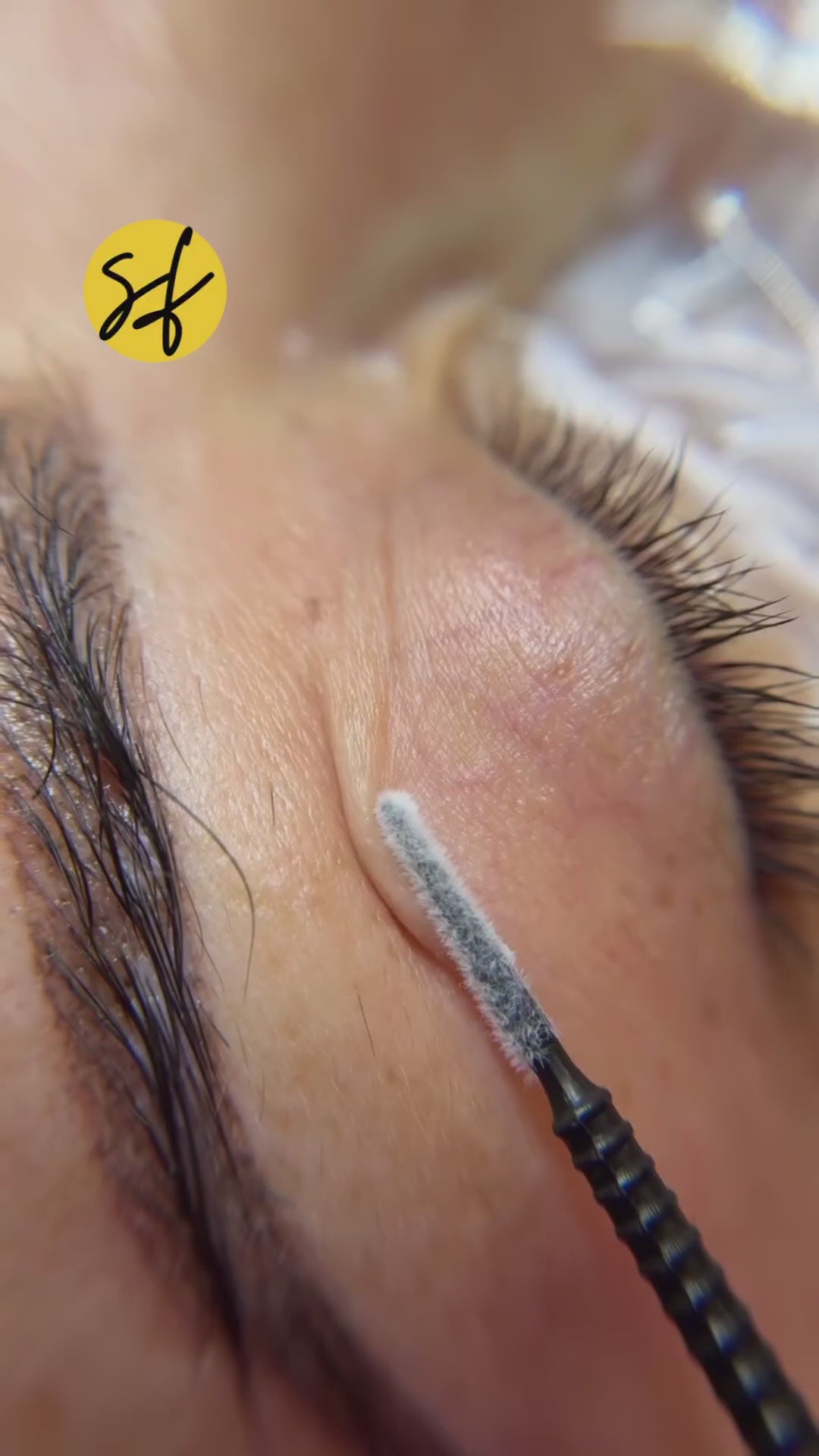 Non-surgical Blephroplasty