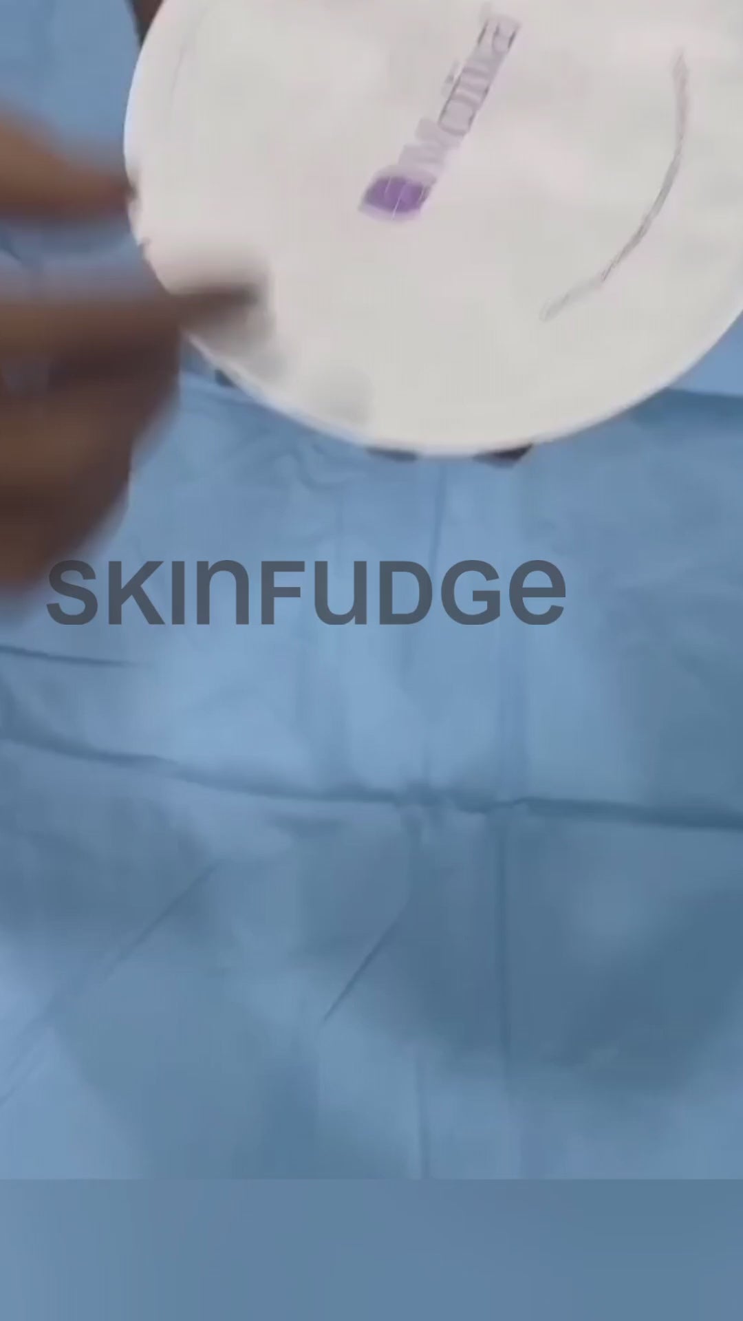 Breast Implant
