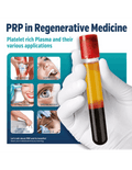 PRP Tube - SKINFUDGE Aesthetics | Painless, No Side Effects, Natural Looking Results