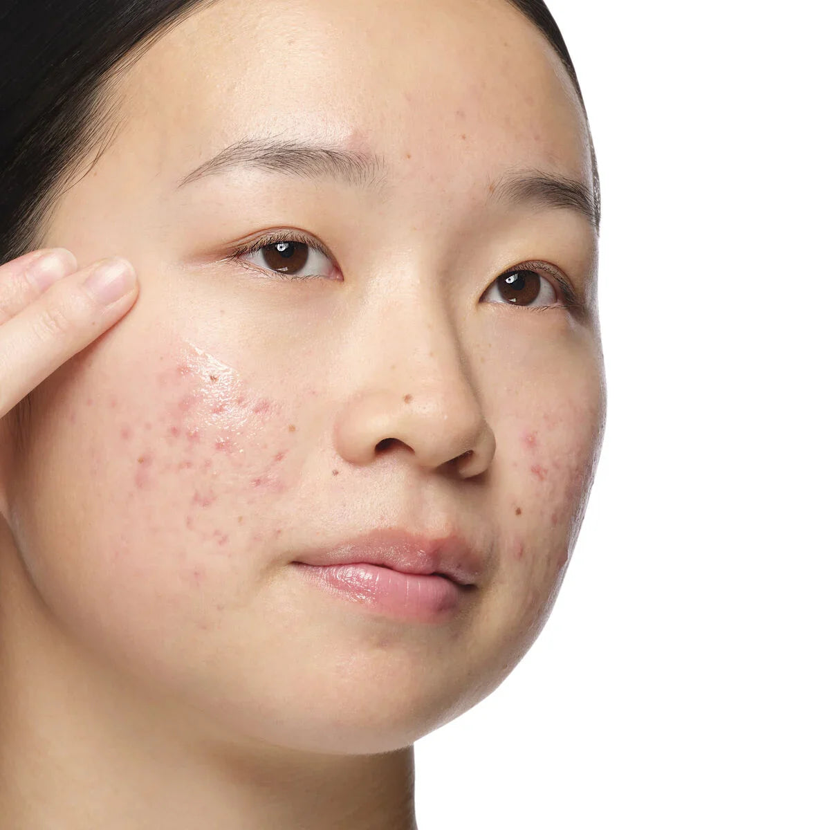 The Ordinary Aloe 2% + NAG 2% Solution – SKINFUDGE Aesthetics