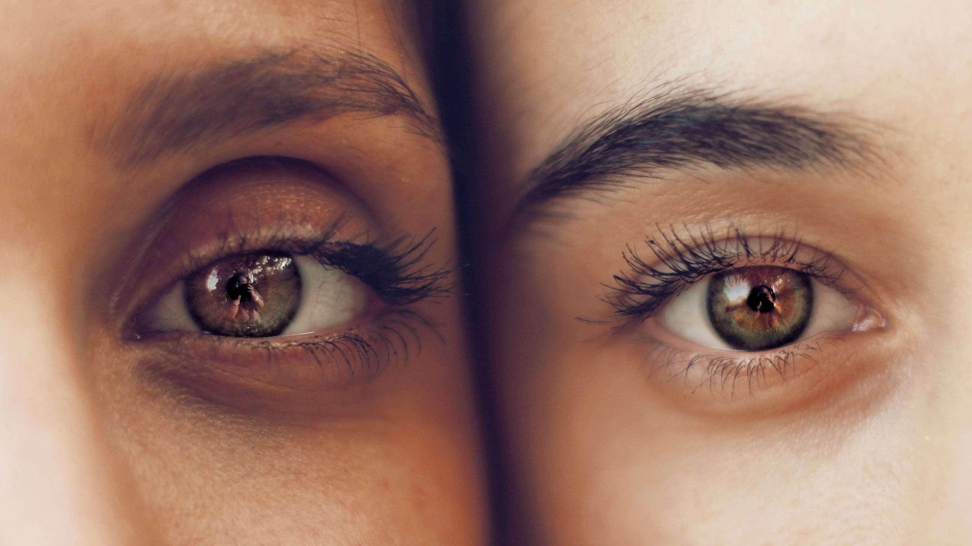 Carboxytherapy Treatment for Dark Circles - SKINFUDGE Aesthetics | Painless, No Side Effects, Natural Looking Results