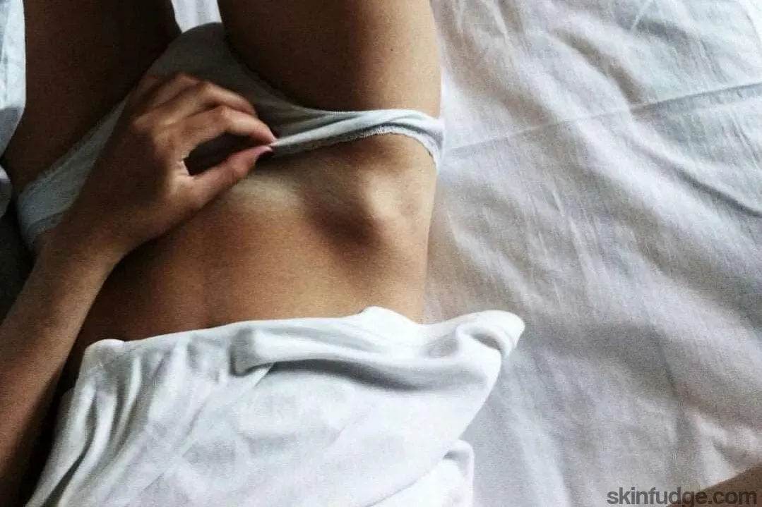 Vaginal Skin Lightening (Vaginal Bleaching) - SKINFUDGE Aesthetics | Painless, No Side Effects, Natural Looking Results