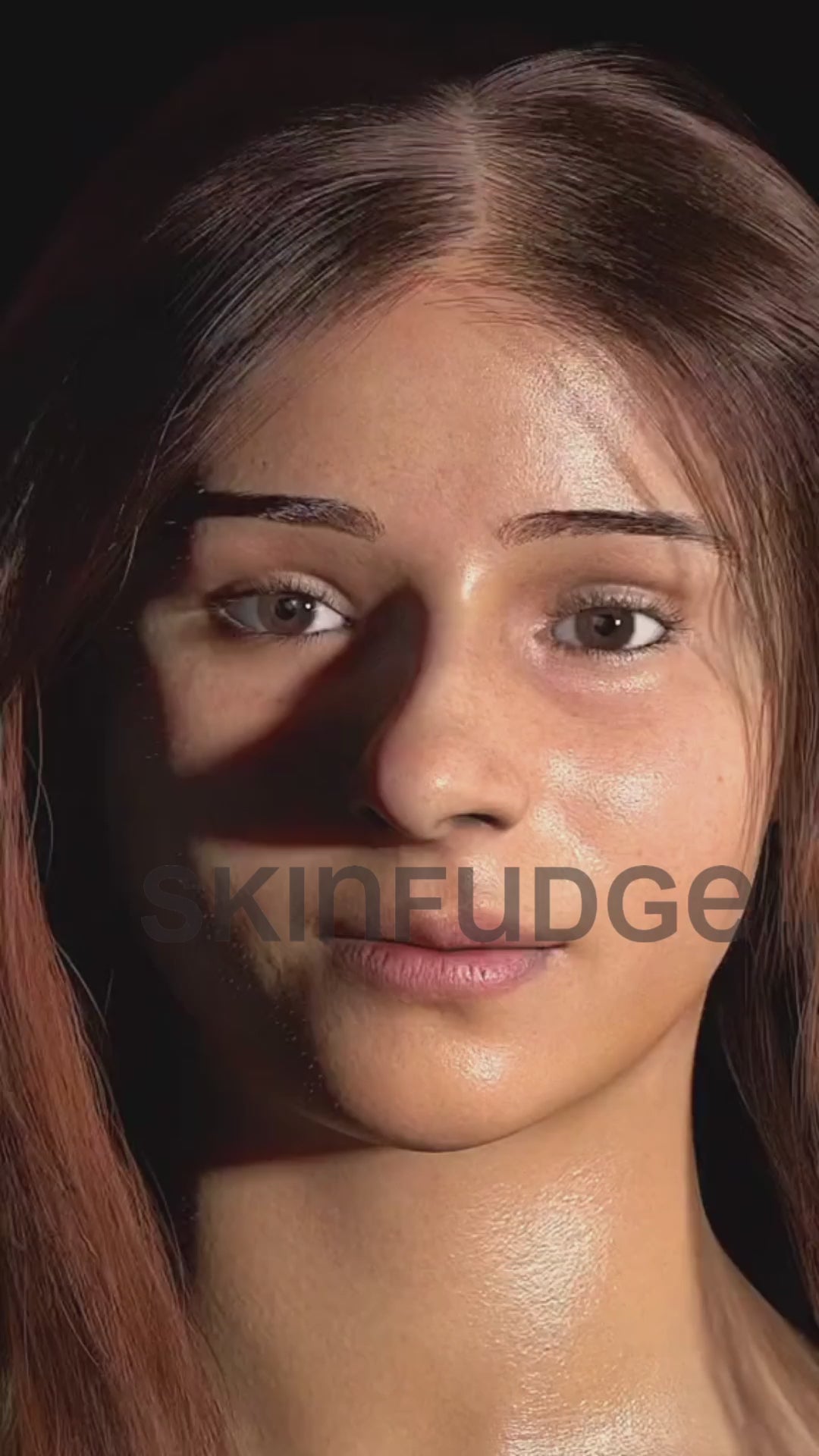 Cosmetic Rhinoplasty (Nose Reshaping Surgery)
