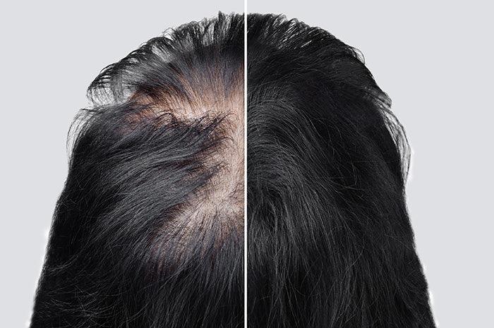 Best Hair Specialist in Lahore-SKINFUDGE