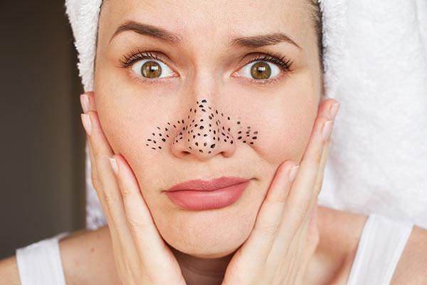Blackhead Removal - SKINFUDGE Aesthetics | Painless, No Side Effects, Natural Looking Results