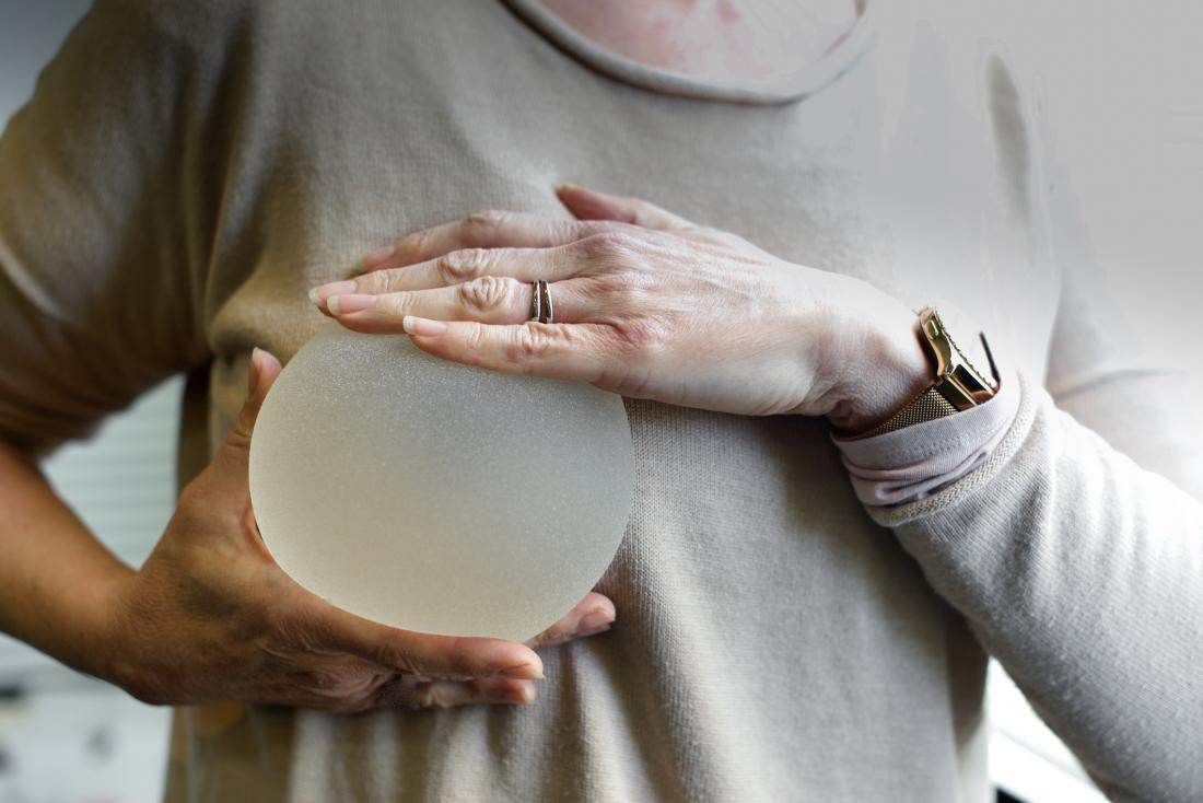 Breast Implant - SKINFUDGE Aesthetics | Painless, No Side Effects, Natural Looking Results