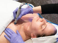 Hydrafacial (Face & Neck) - SKINFUDGE Aesthetics | Painless, No Side Effects, Natural Looking Results