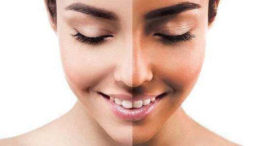 Tan Removal / Reduction Treatment - SKINFUDGE Aesthetics | Painless, No Side Effects, Natural Looking Results